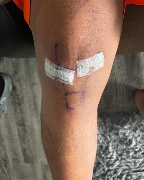 Aubrey Keys' Recovery: More Than Just A Comeback Story Image 9