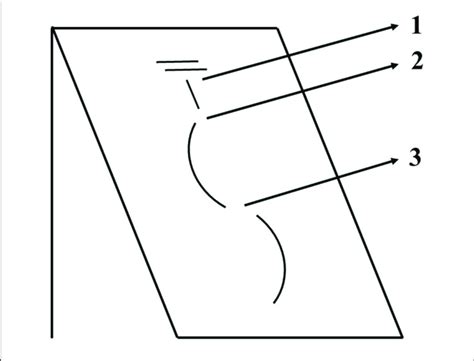 schematic representation   beginning   turn sequence