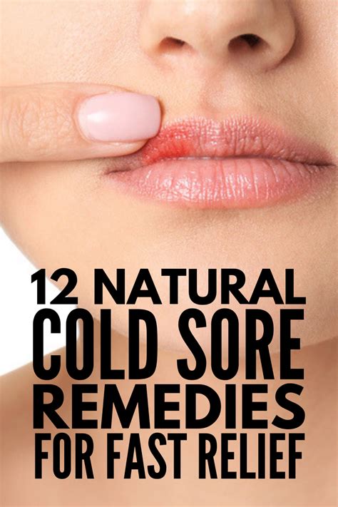 Fast and effective 12 natural cold sore remedies that work – Artofit