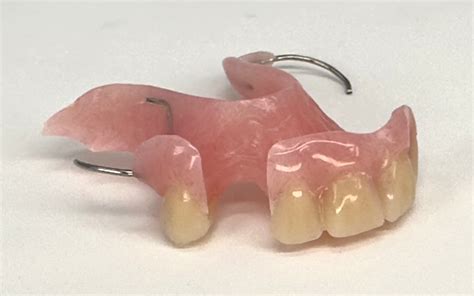 acrylic partials flexible  affordable partial dentures