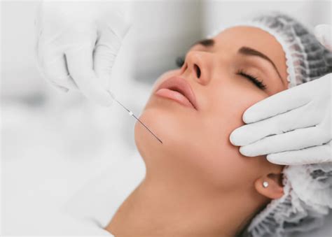 expect  thread lifting dr jaclyn wong melbourne