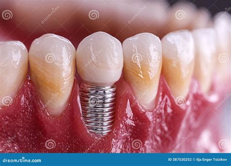 Comprehensive 3D Dental Anatomy Visualization Explore Tooth Structure ...