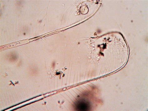 how to remove parasites from dogs naturally