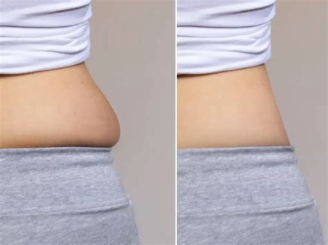 Emsculpt vs CoolSculpting: Which is Best for You? - konmison