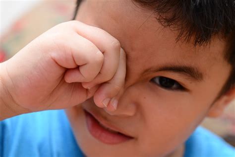 Children with blepharitis need treatment? | Vinmec