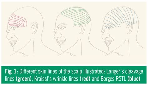 Why your scar tissue isn’t an issue | Biomechanics in the Wild