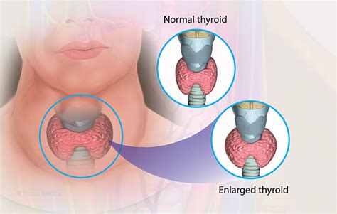 Health Condition : Symptoms, Causes, Treatment and More