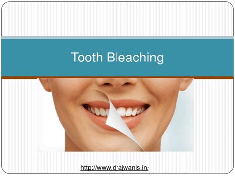 Overview of Tooth Bleaching by Pune’s Best Dentist – Dr Ajwani