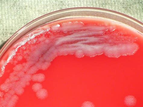 Bacillus Anthracis | howMed Images
