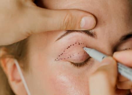 What Causes Droopy Eyelids - The Esthetic Clinic Blog