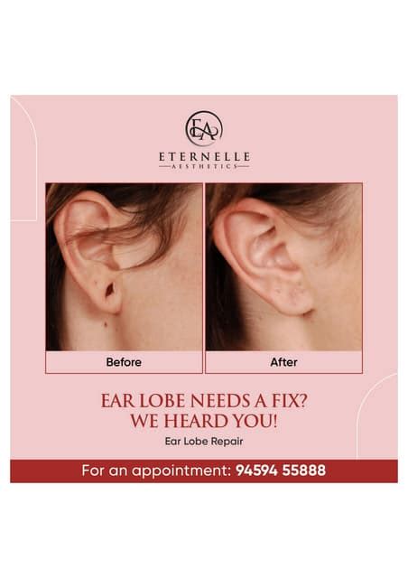 ear lobe repair procedure eternell aestheticspdf