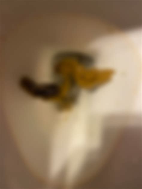 Is that blood? I can’t seem to firm up my poop. Eating tons of fiber