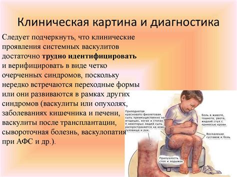 Системные васкулиты - online presentation