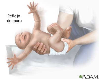 O Que É Reflexo De Moro - Reflejo de moro: MedlinePlus enciclopedia médica illustración