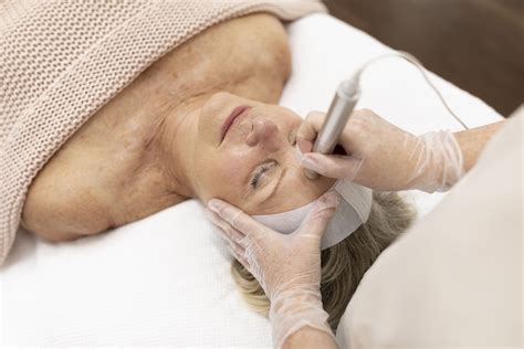 skin needling brisbane rejuvenate  skin heart space beauty