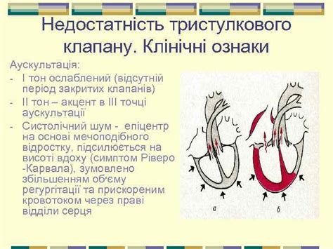 Набуті вади серця Класифікація набутих вад серця