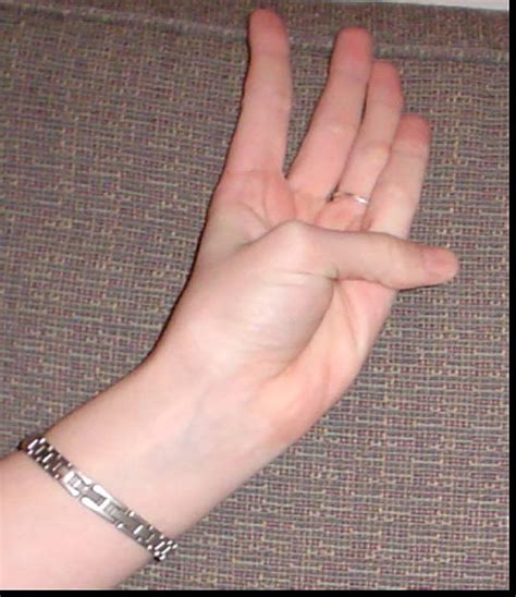Accuracy of the “Thumb-Palm Test” for Detection of Ascending Aortic ...