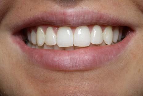 Tooth Talk | Dentist in Bolton, Staffordshire, Southport, Salisbury