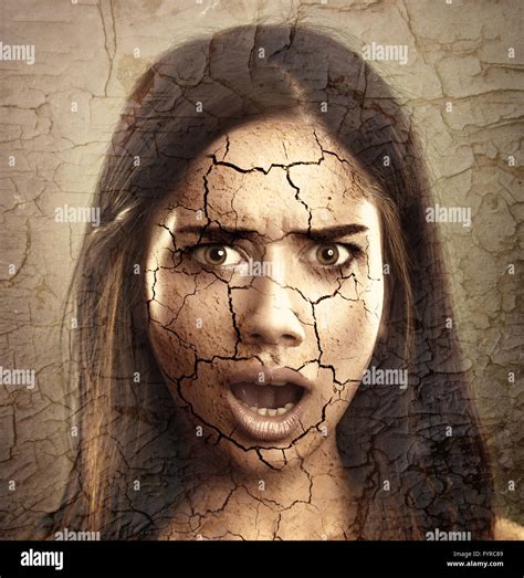 Dry cracked skin hi-res stock photography and images - Alamy