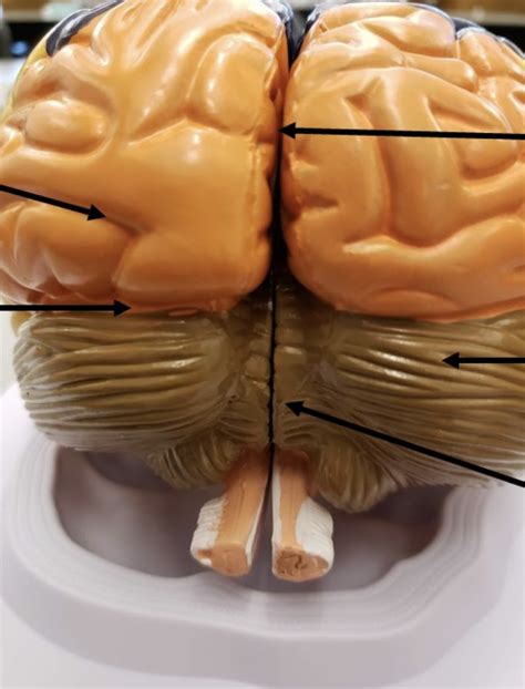 posterior view  brain diagram quizlet