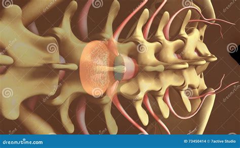 spinal anaesthesia stock illustration illustration  fentanyl