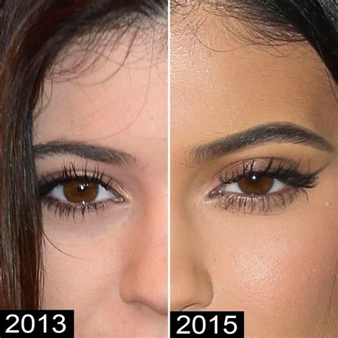Plastic Surgery? See Kylie Jenners Body Change Over Time | Life & Style