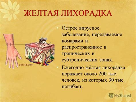 Лихорадка желтая фото