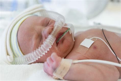 nitrogen oksida kegunaan dosis efek samping  sehat