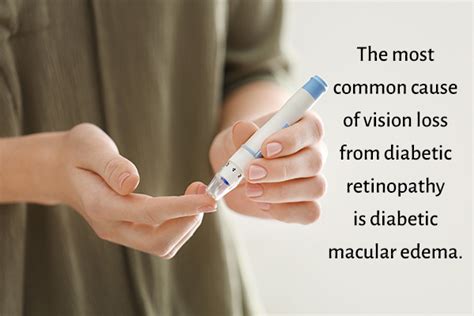 Macular Edema: Causes, Symptoms, & Treatment - eMediHealth