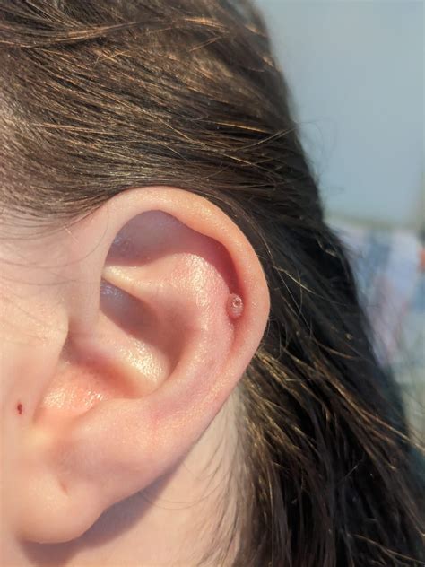 Looking for advice on what this lump is. : r/piercing