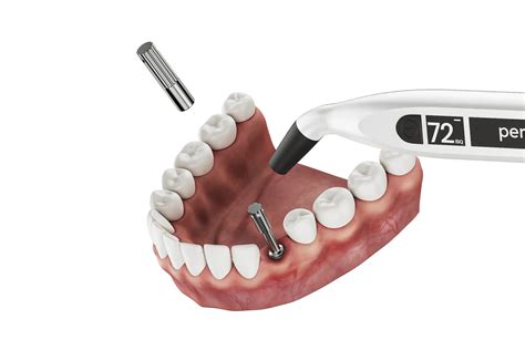 Insightful 3D Rendering Case Study