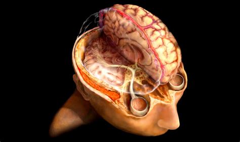 Optic Nerve Disorders - StoryMD