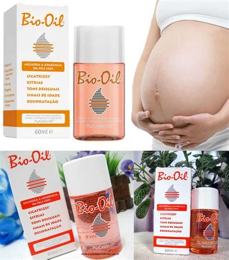Oleo Bom Para Estrias - Óleo Para Cicatrizes e Estrias Bio Oil 60 ml | Ofertinha Promoções