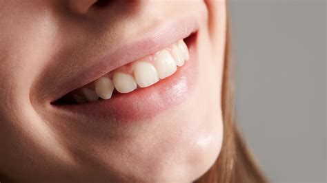 por  los seres humanos tenemos dientes caninos cambio colombia