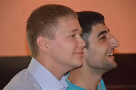 Armenian nose. Why do Armenians have big noses? - News and Society