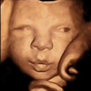 ultrasound  baby scan baby sonar