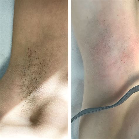 thick dark underarm hair