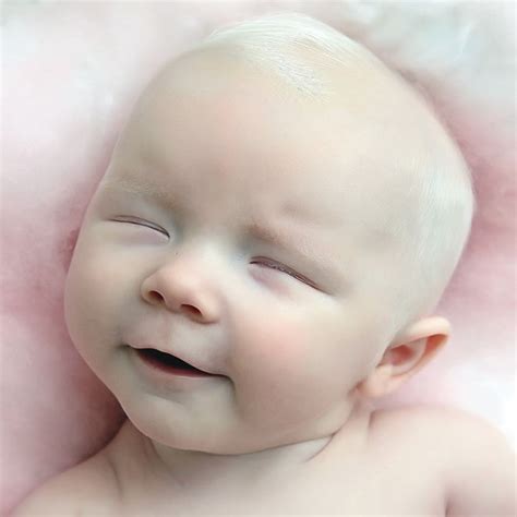 albino   family tribune