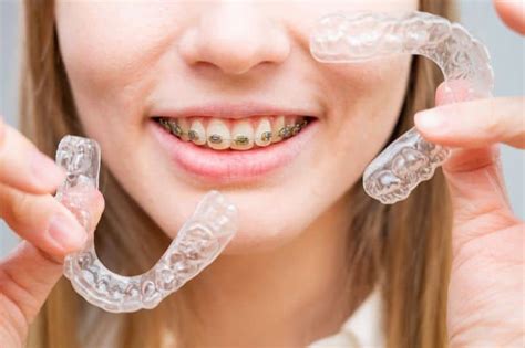 night guard  braces   alleviate teeth grinding