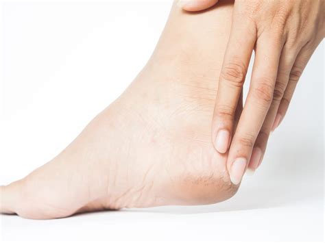 fix cracked heels permanently