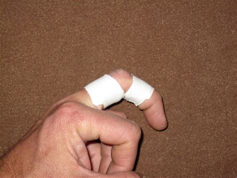 Finger Flexor Tendon Pulley Injuries – Eastern Sierra Physical Therapy