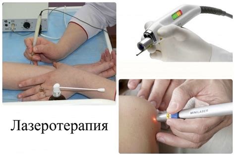 Новообразования на коже: фото и описание, виды, на голове, руках, лице ...