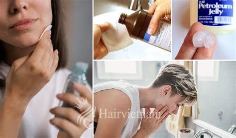 how to get hair dye off hair