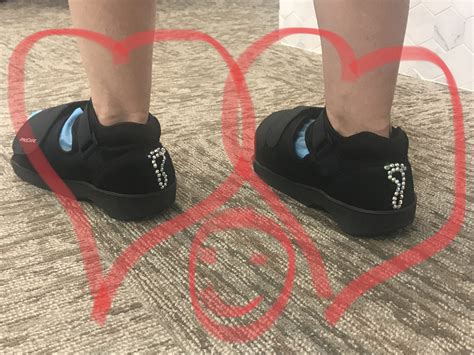 When is a Good Time to Have Minimally Invasive Bunion Surgery?