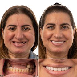 JAX DENTAL IMPLANTS & DENTURES - 22 Photos - 11645 Beach Blvd ...