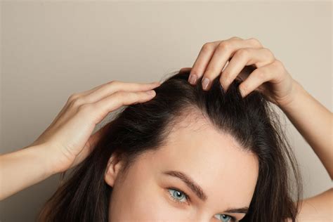 Itchy Scalp And Hair Loss: Could There Be A Connection? | Kintsugi Hair