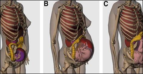 Guess What Happens To Your Internal Organs During Pregnancy | Pregnancy ...