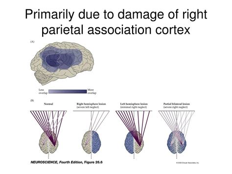 PPT - The Association Cortex PowerPoint Presentation, free download ...