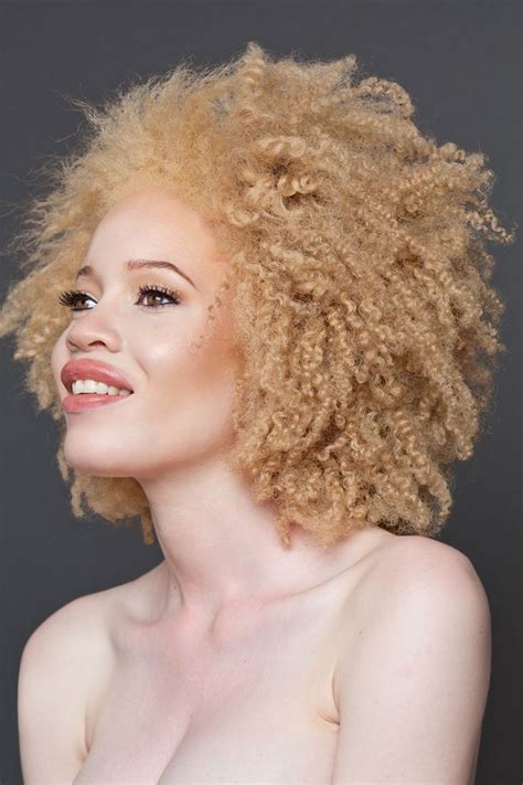 Albino African Model