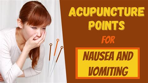 Basic Acupuncture Points for Nausea & Vomiting #shorts - YouTube